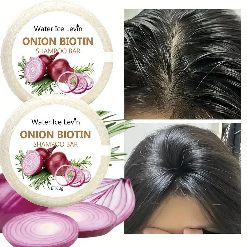 Onion and Biotin Shampoo Soap - 60g, Suitable for All Hair Types, Moisturizing and Smoothing, Rich in Rosemary Extract
