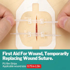 Sanke Rescue Wound Closure Strips Butterfly Bandages, Laceration Closure Kit, 14/28 pack