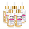 Pack of 5