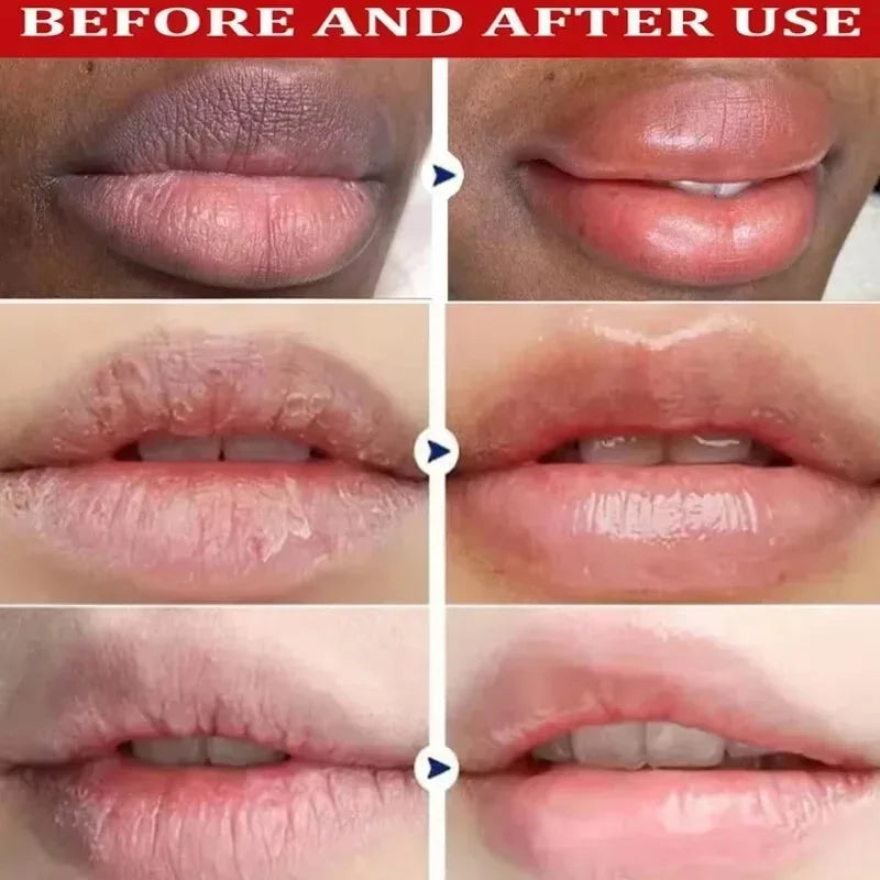 Fast Remove Dark Lip Balm Serum Lighten Melanin Lip Mask Exfoliating Fade Lip Lines Dead Skin Nourishing Repair Lip Care Makeup