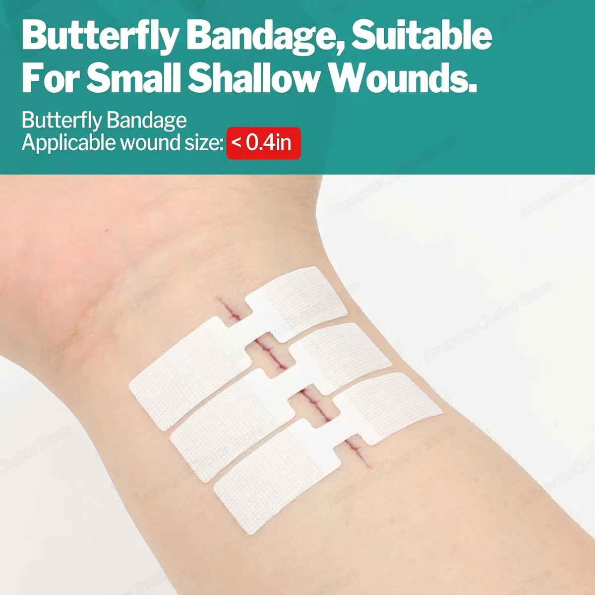 Sanke Rescue Wound Closure Strips Butterfly Bandages, Laceration Closure Kit, 14/28 pack